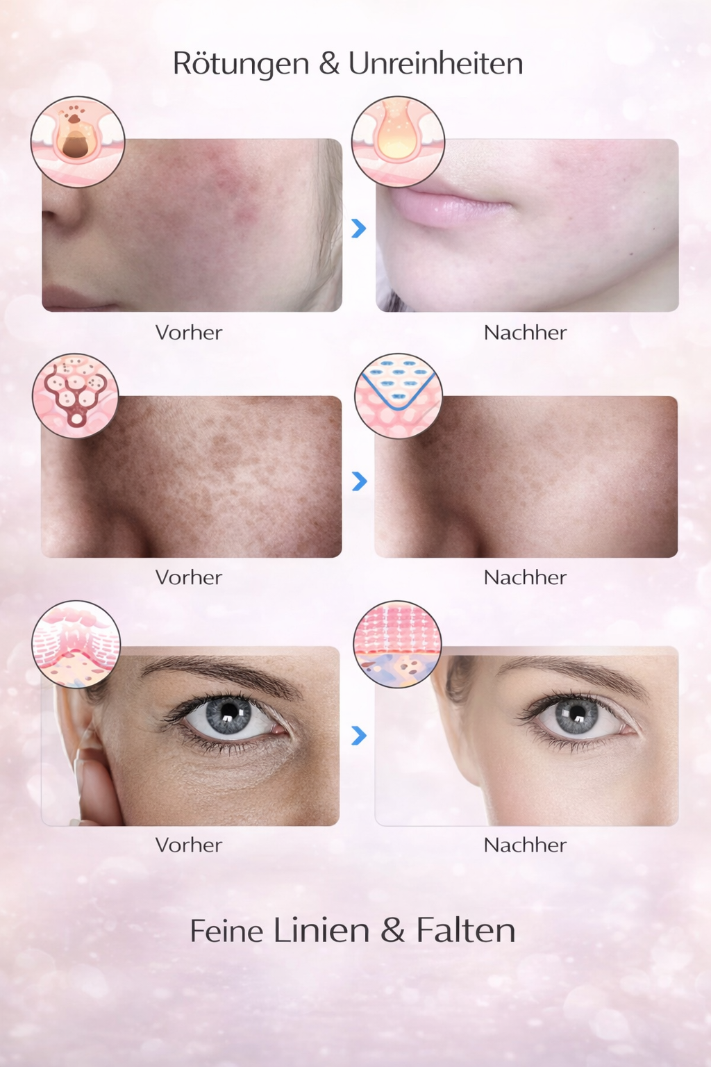 LumiSkin LED – Professionelle Lichttherapie für deine Haut